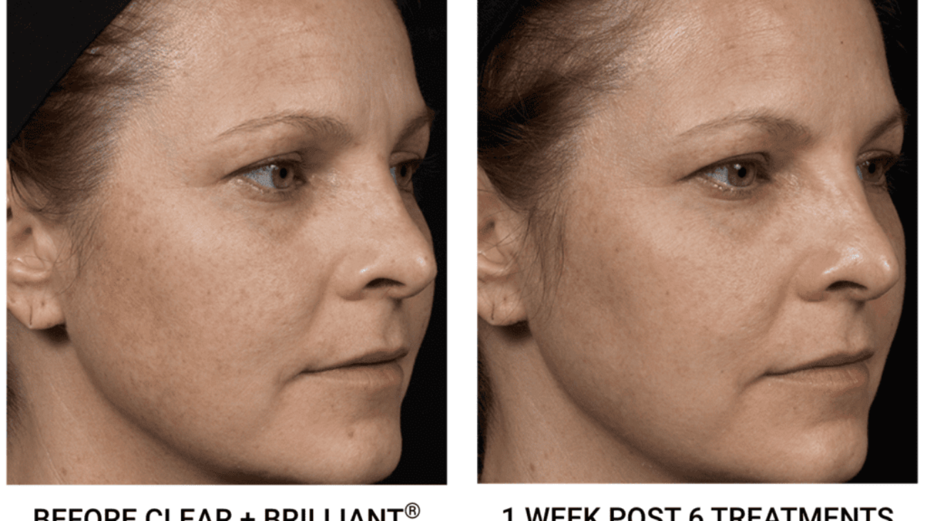 How to Care for Your Skin Before and After Med Spa Treatments