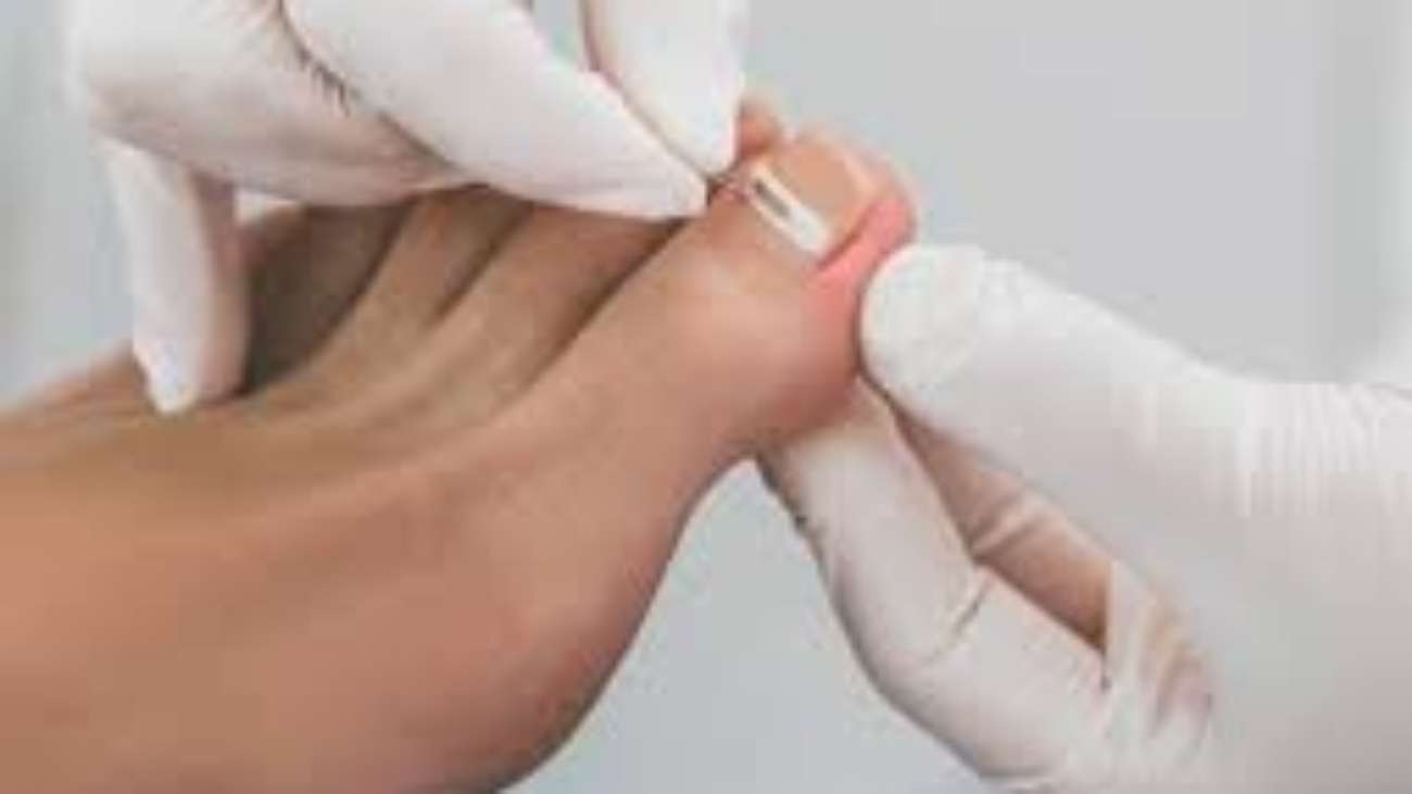 What To Know When Choosing a Podiatrist